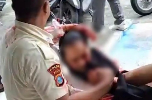 Mahasiswi semester akhir UIN Suska Riau dibacok.(foto: tribunpekanbaru.com)