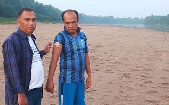 Amat, warga Desa Sikakak tangannya robek akibat terkaman buaya di Sungai Batang Kuantan (foto/Bayu)
