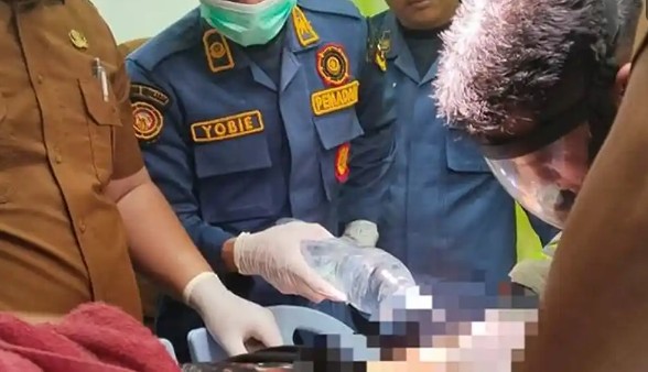 Evakuasi menegangkan di IGD RSD Madani, Damkar Pekanbaru lepaskan cincin dari alat vital pria (foto/ist)